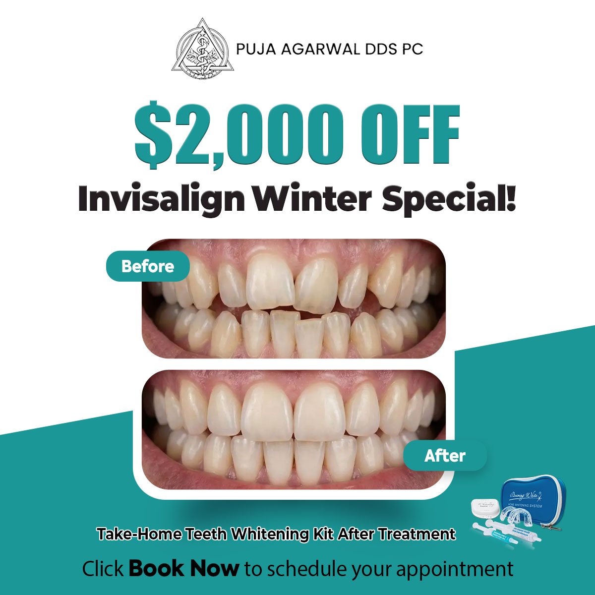 Complete Family Dental Care Facebook ad: Invisalign Provider in Bethesda!