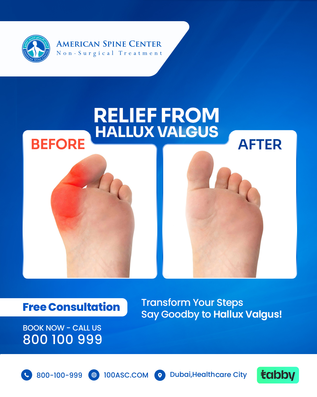 American Spine Center Facebook ad: Say Goodbye to Bunions, Free Consultation Available! Call…