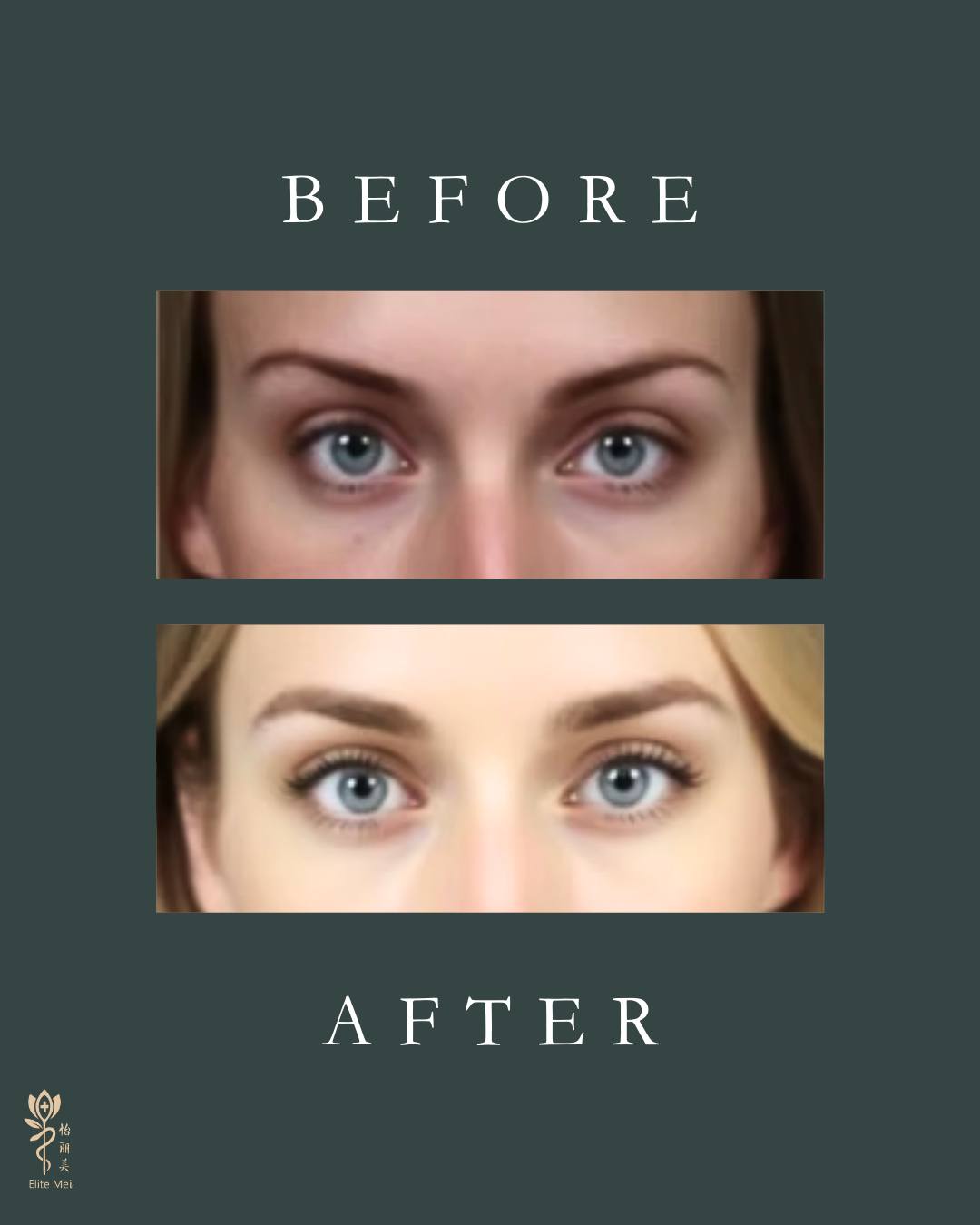 Elite Mei Wellness and Hair Restoration Facebook ad: Sparse Brows? There’s a Permanent Solution.