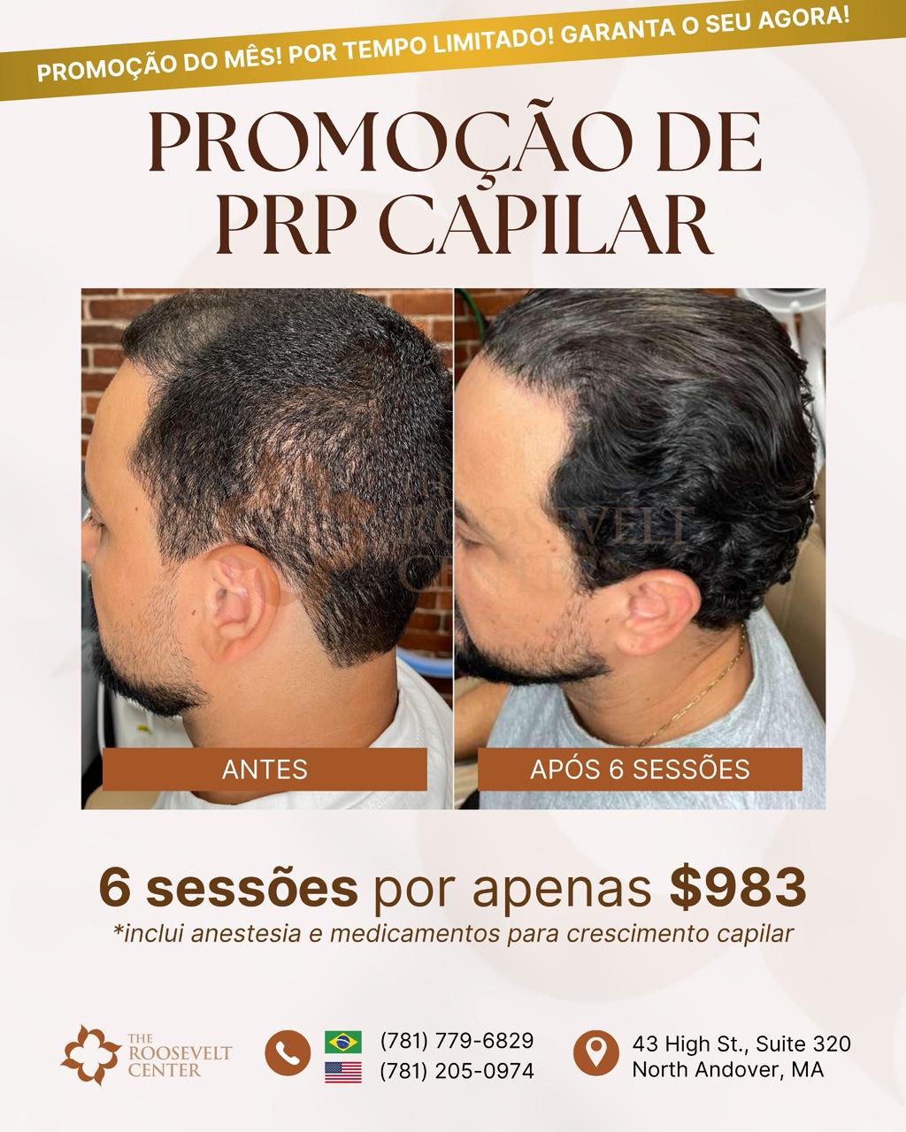 The Roosevelt Center MA Facebook ad: HAIR PRP
