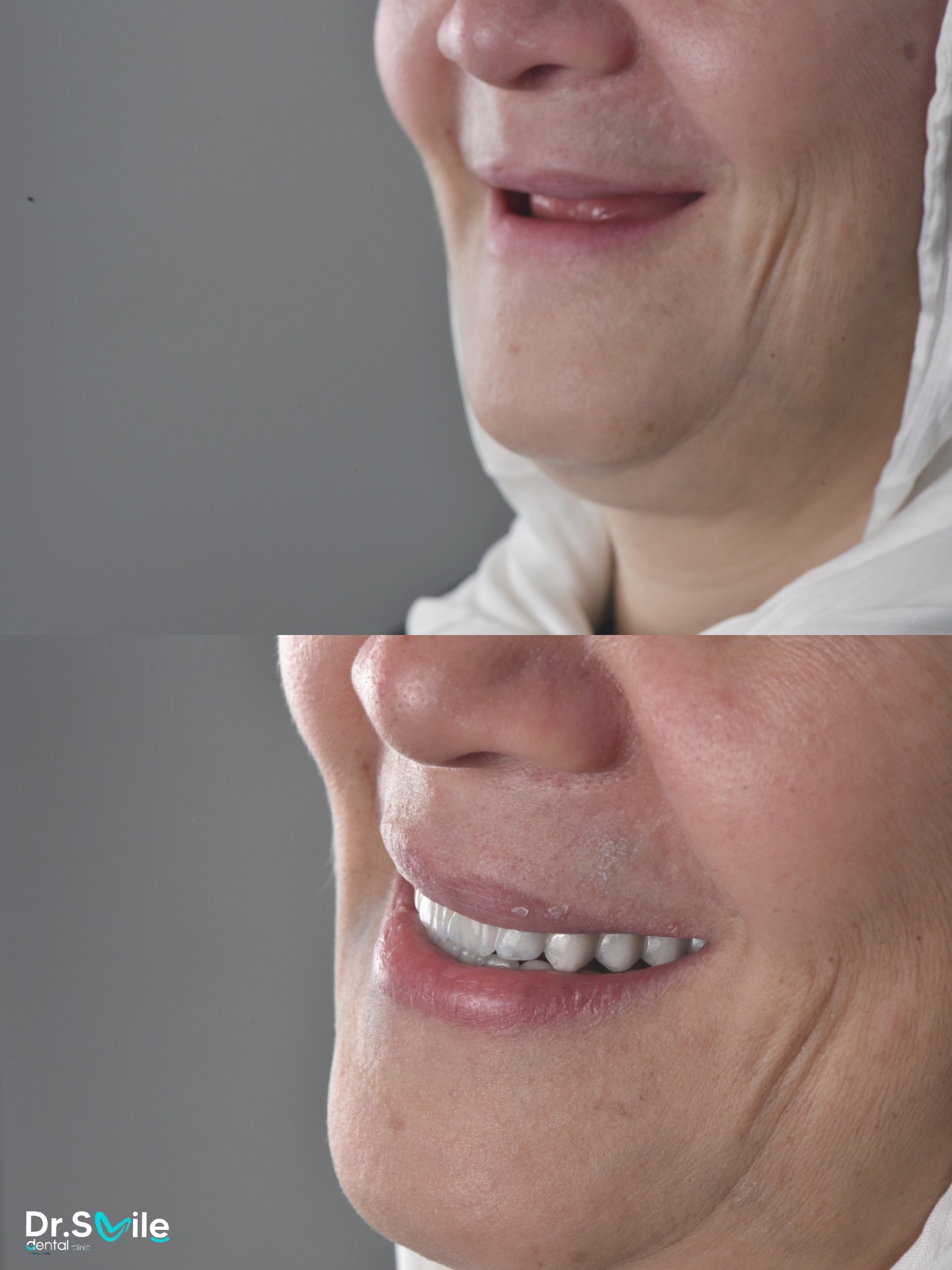 Dr.Smile Dental Clinic - لزراعة وتجميل الأسنان Facebook ad