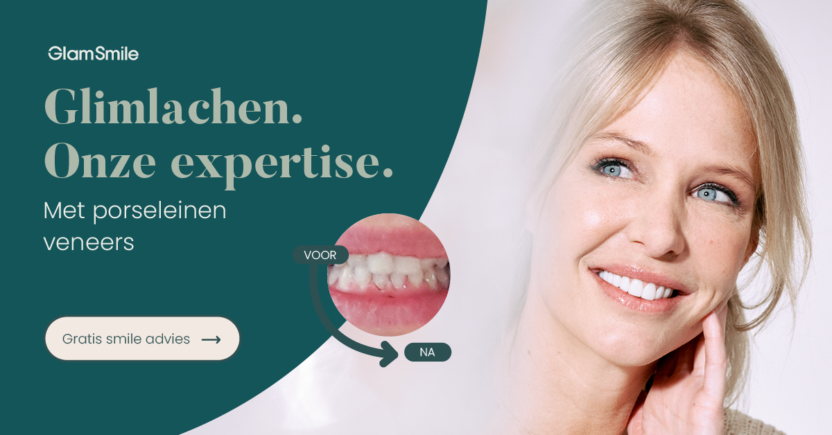 GlamSmile Belgium Facebook ad