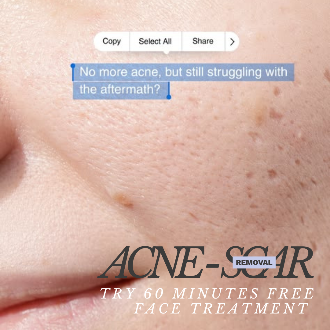 Better Skin Aesthetics Facebook ad