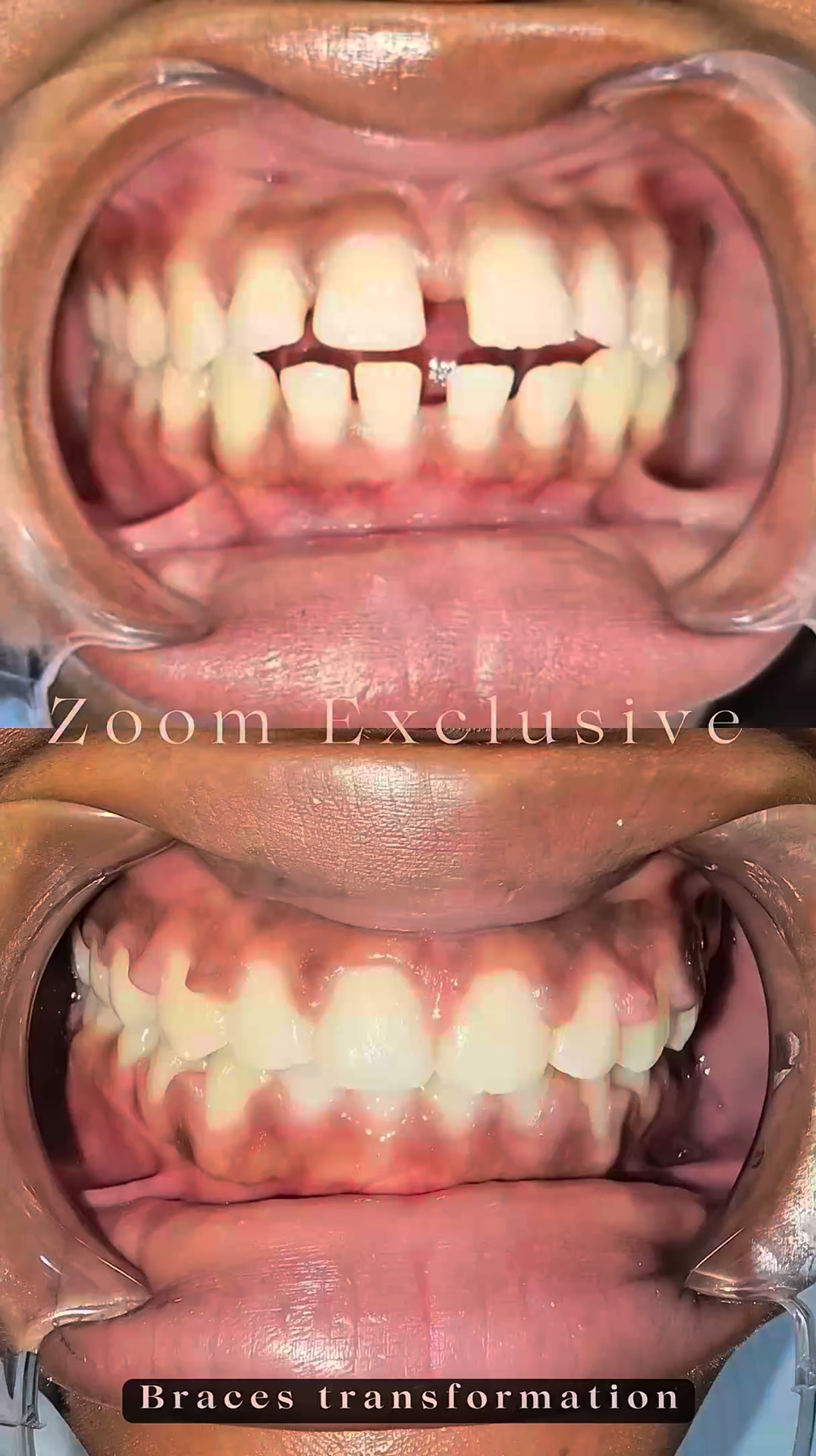 Zoom Exclusive Dental Care PHC Facebook ad