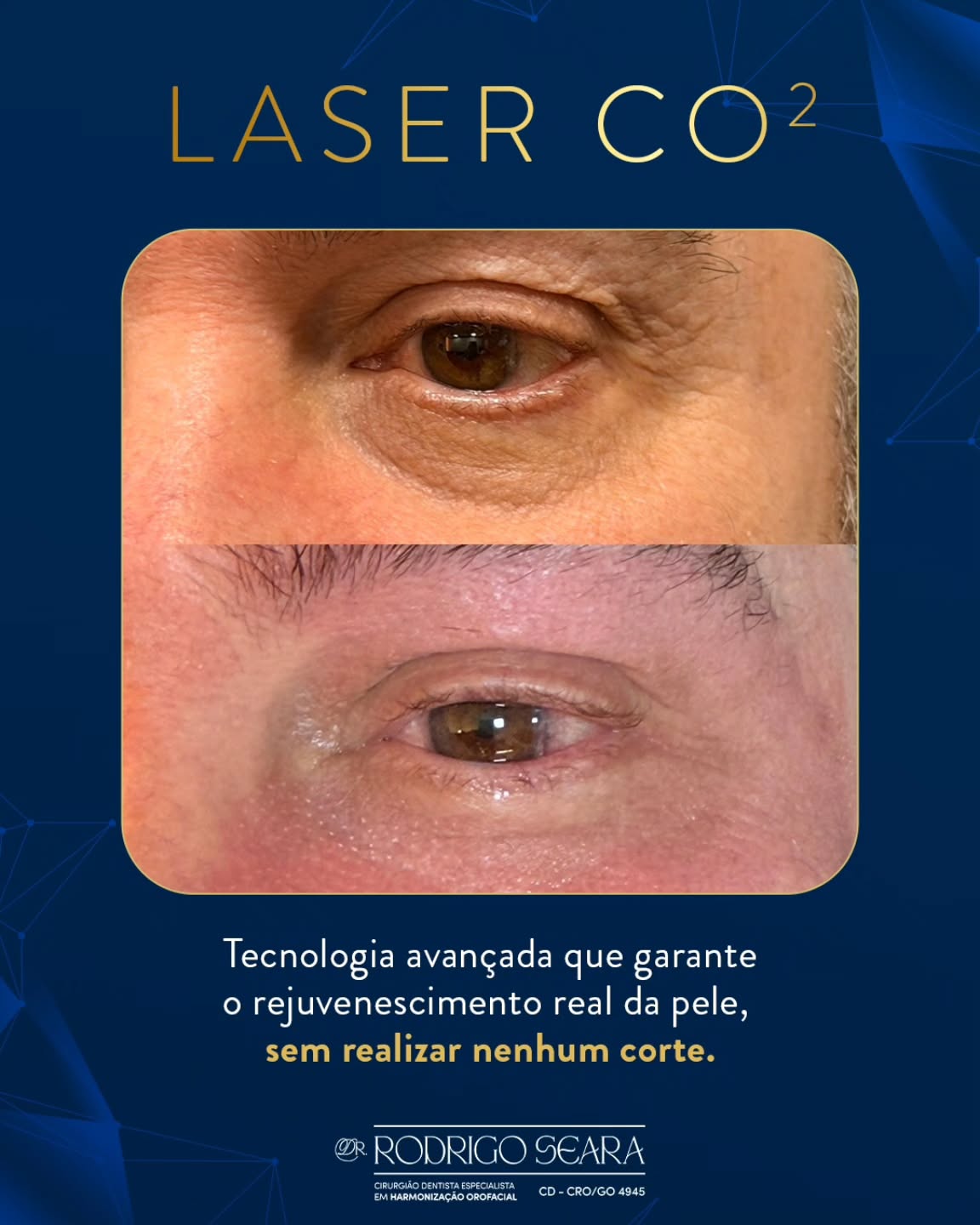 Rodrigo Seara Paes Facebook ad: O Laser CO₂ é um dos tratamentos mais…