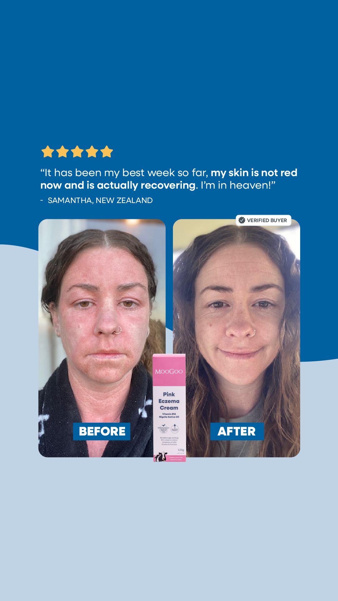 MooGoo Skin Care Facebook ad