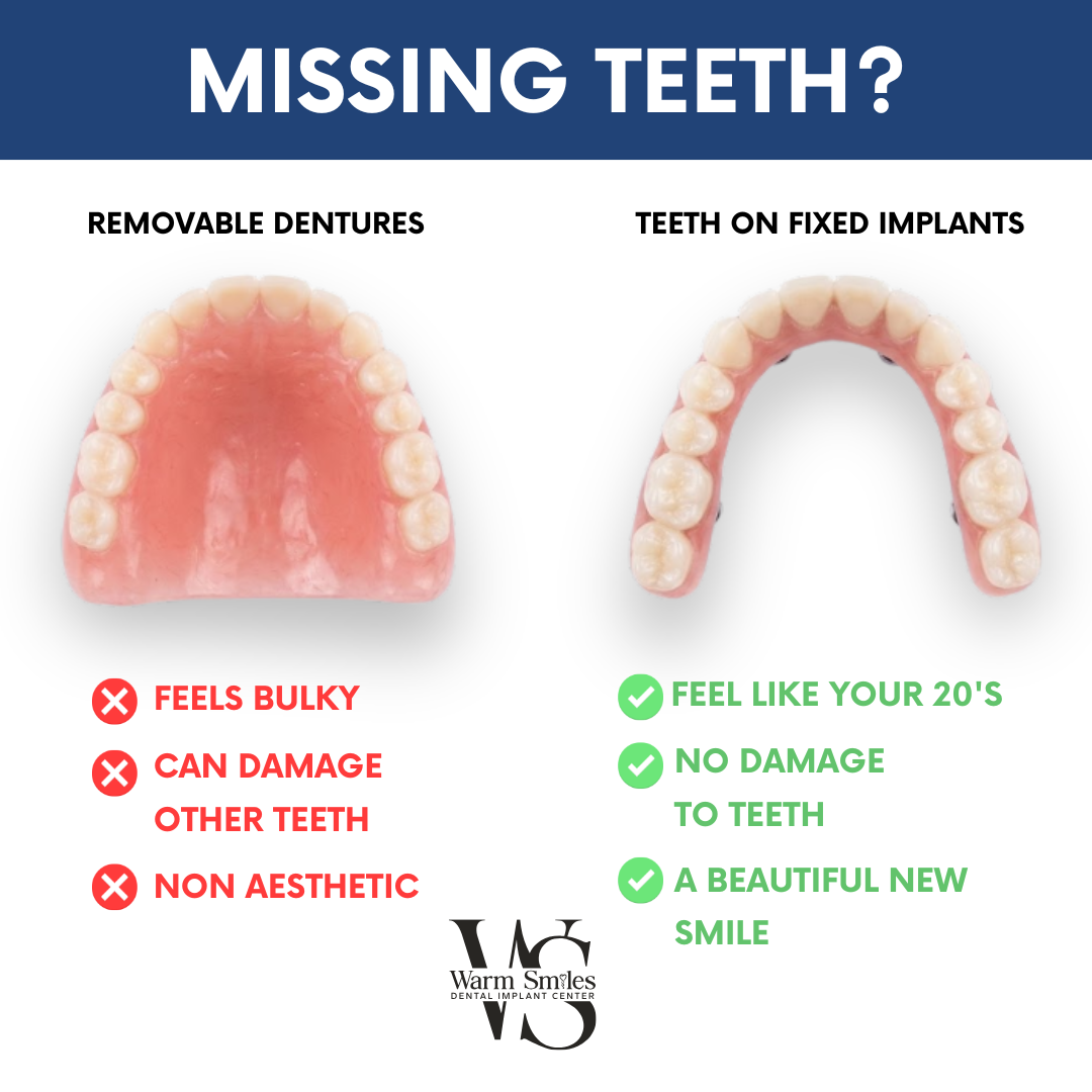 Warm Smiles Dental Implant Center Facebook ad