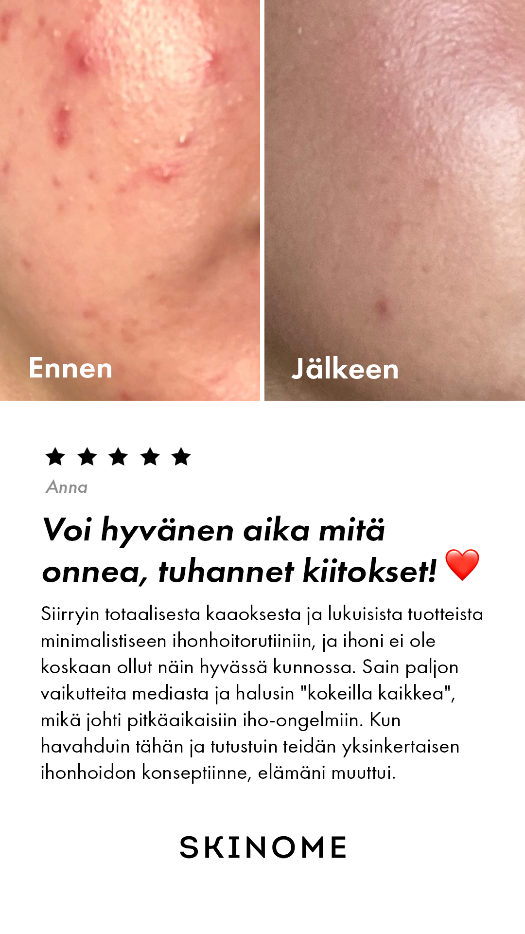 Skinome Facebook ad