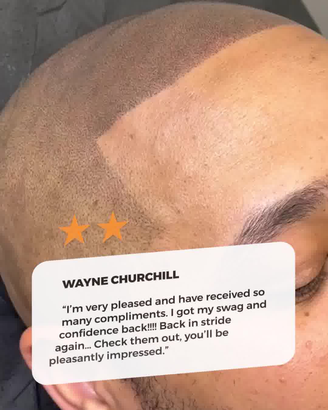 Exclusive Experience Company Facebook ad: Lafayette, Fight Back Against Hair Loss