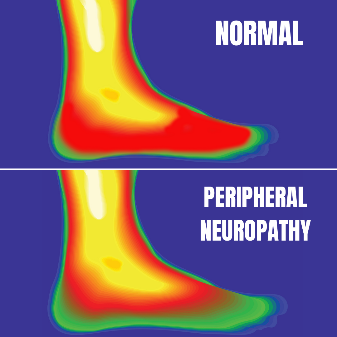 Dr. Joshua Huffman, Chiropractic Neurologist Facebook ad: Breakthrough Neuropathy Options | FREE Consultation