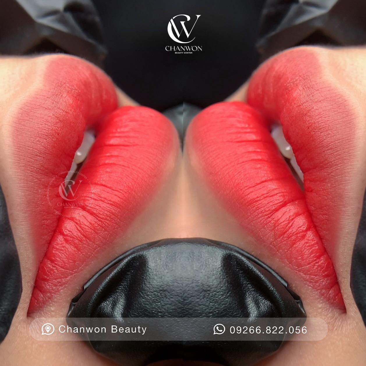 Chanwon Beauty Clinic - Quezon Facebook ad: Soft Lips Collagen at Chanwon Beauty
