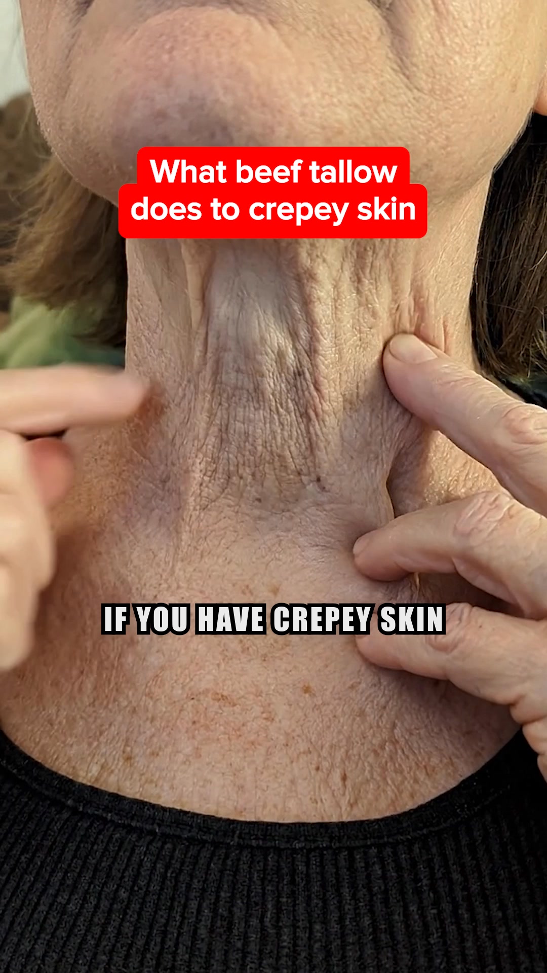Based Supplies Facebook ad: Restore Your Skin in 3 Weeks!