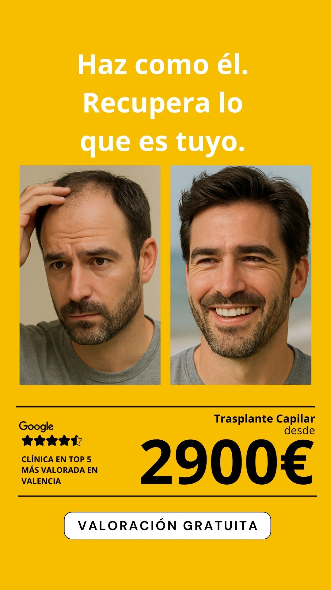 Clínica salud capilar  Facebook ad