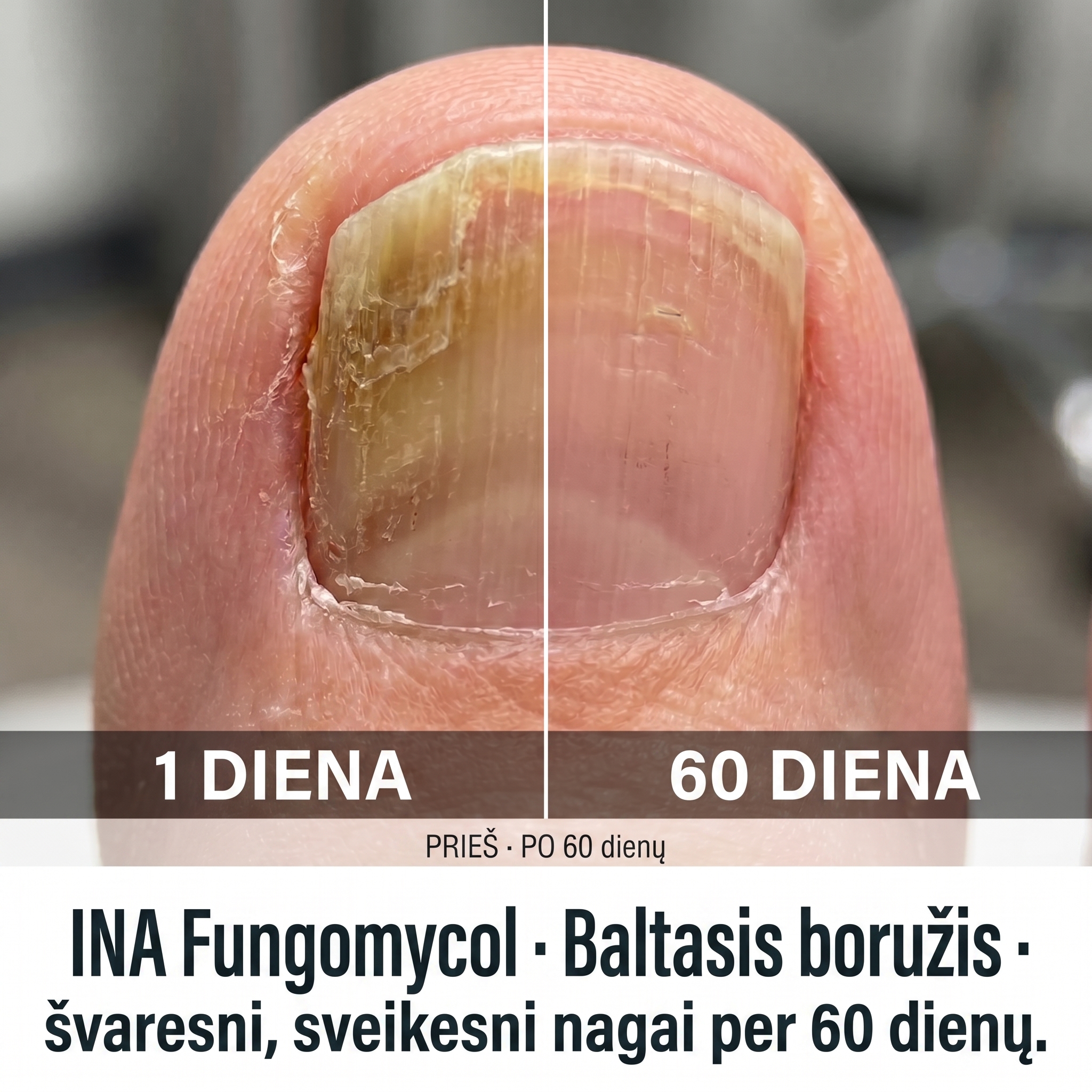 InaEssentials.lt - Organinė Kosmetika Facebook ad: Diena 1 ir diena 60. Matai skirtumą?