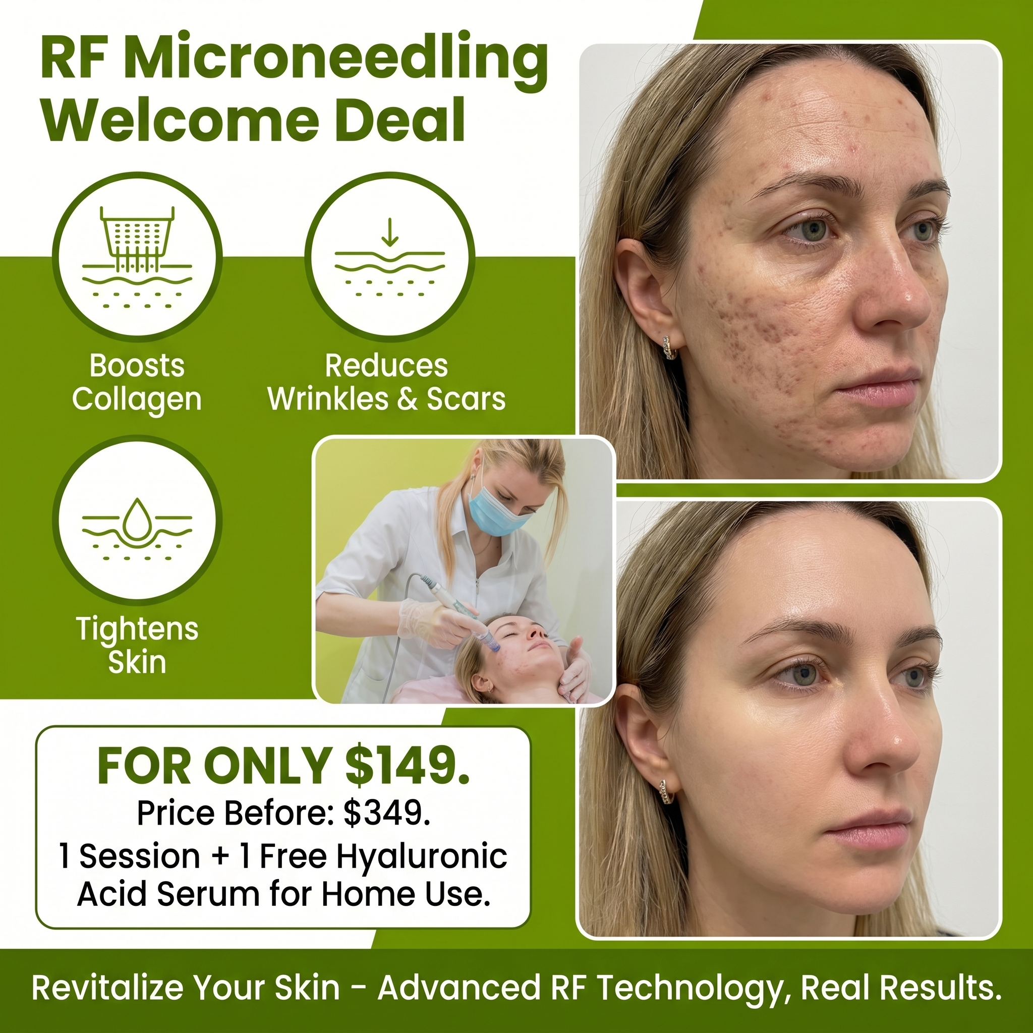 Green Leaf Medi Spa Facebook ad