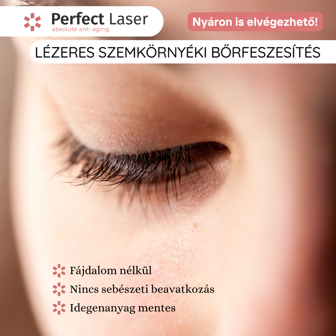 Perfect LASER Facebook ad