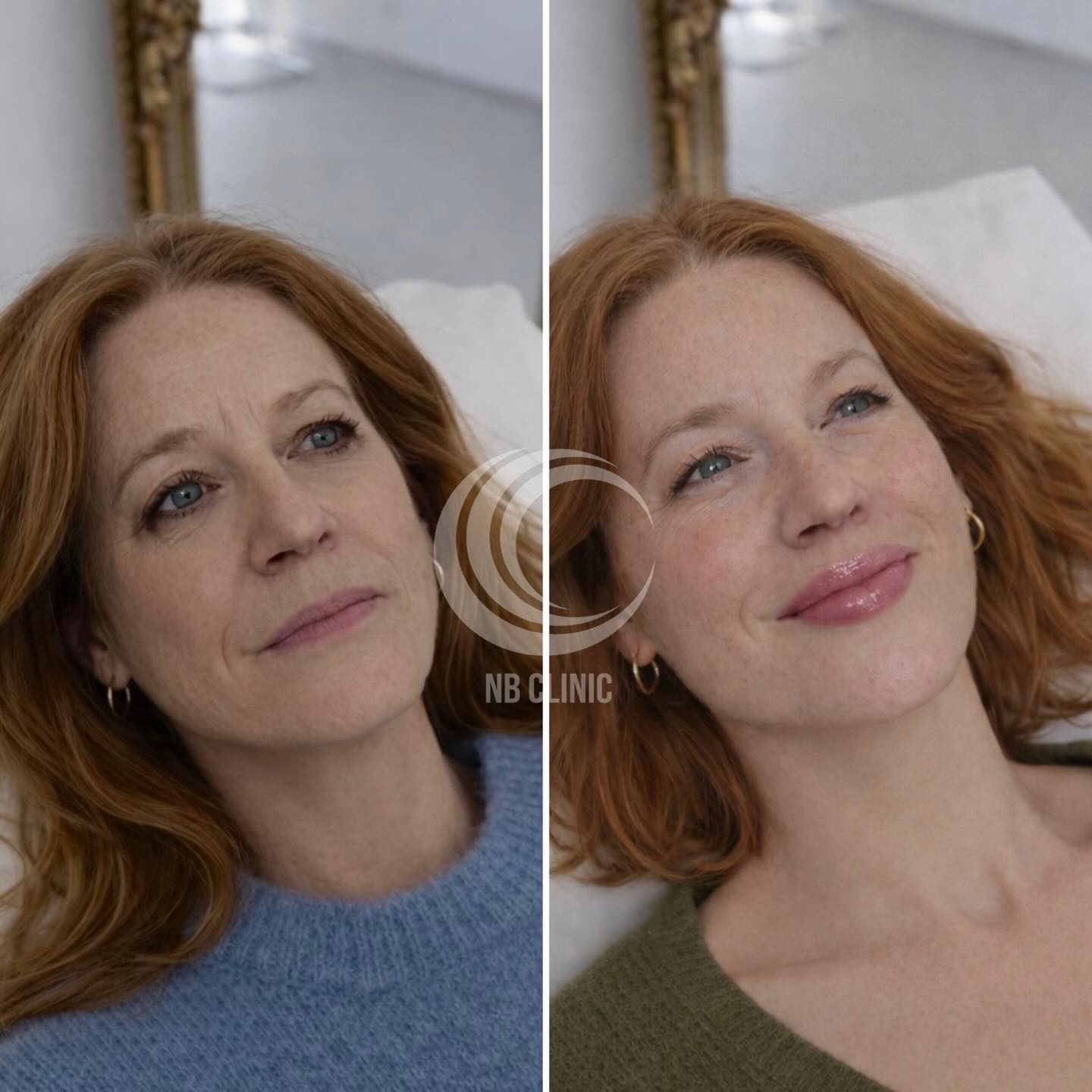NBclinic Facebook ad