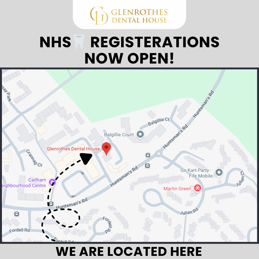 Glenrothes Dental House Facebook ad: Don't wait any longer, claim your NHS check-up spot today!
