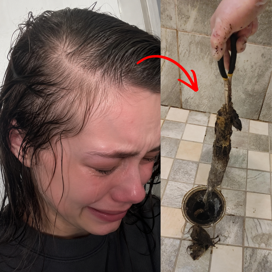 Laura Bennett Facebook ad: Fix Your Just Stress Hair Loss Today