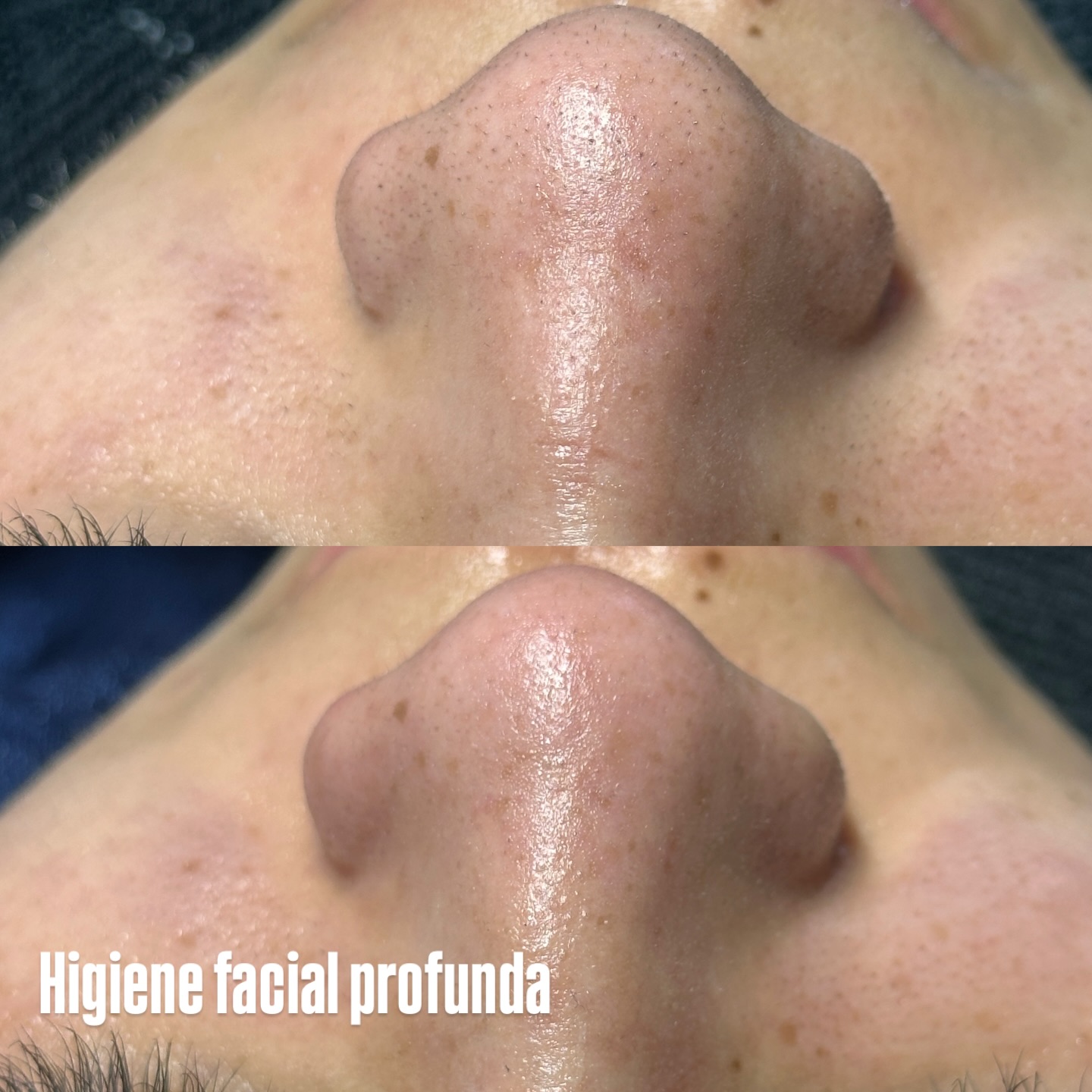 Thalia Perez Facebook ad: Algunos de los tratamientos de esta semana