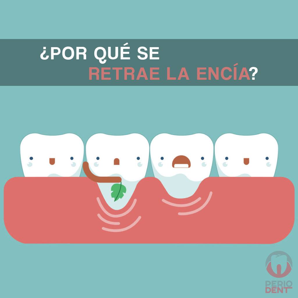 Periodoncia Colima Facebook ad: La retracción de encías (recesiones gingivales) son…