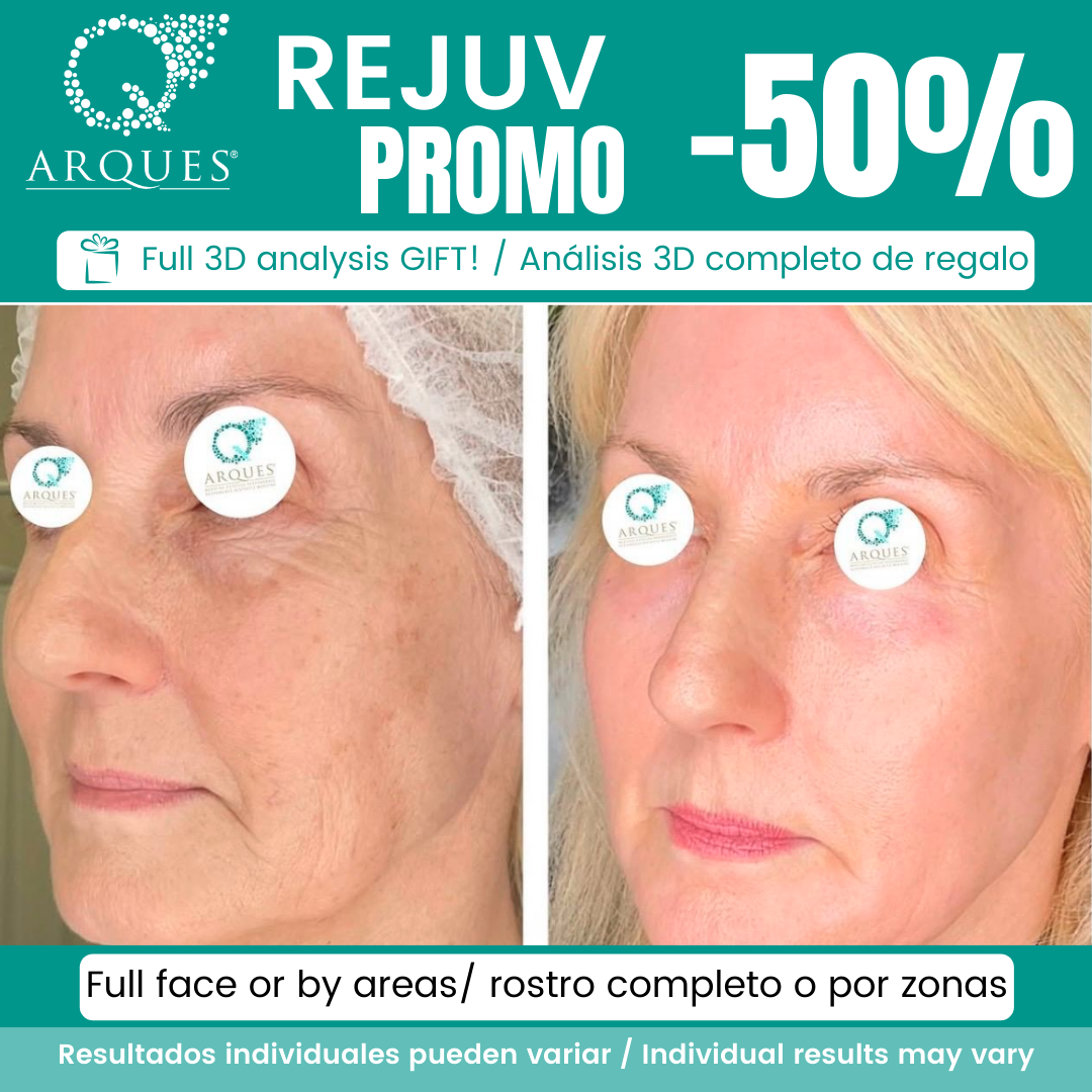 Arques Clinic Marbella Facebook ad: PROMOS DE ENERO | Hasta -65%