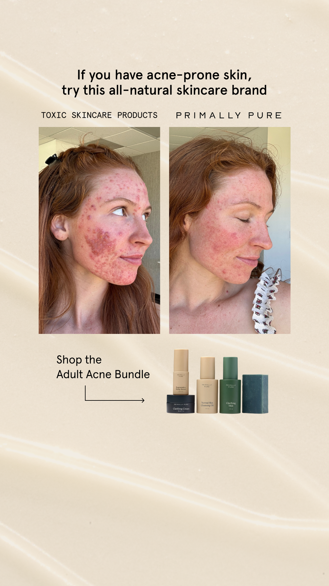 Primally Pure Skincare Facebook ad