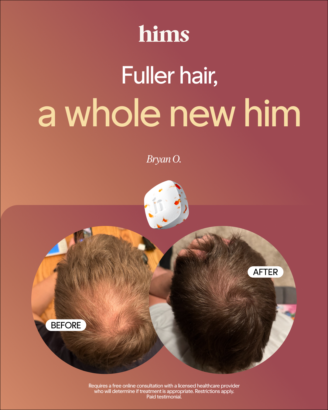 hims Facebook ad