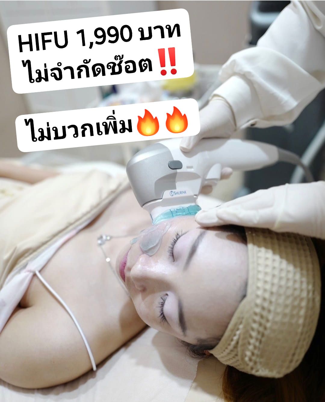MBC Clinic สาขาพระราม2 Botox Filler เลเซอร์ หน้าใส แฟต HIFU Facebook ad: HIFU 1,990 บาท ไม่จำกัดช๊อต