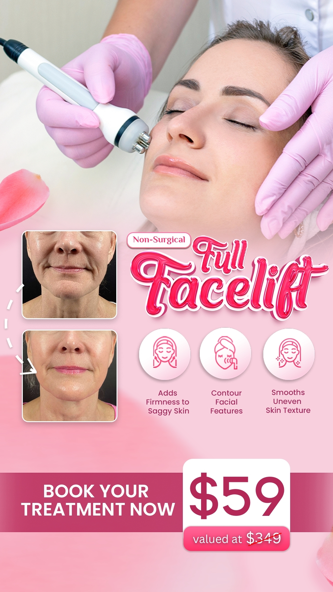 I Love Skin Treatments Facebook ad