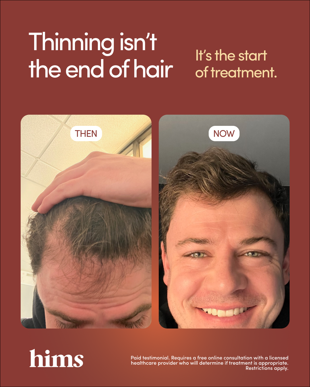 hims Facebook ad