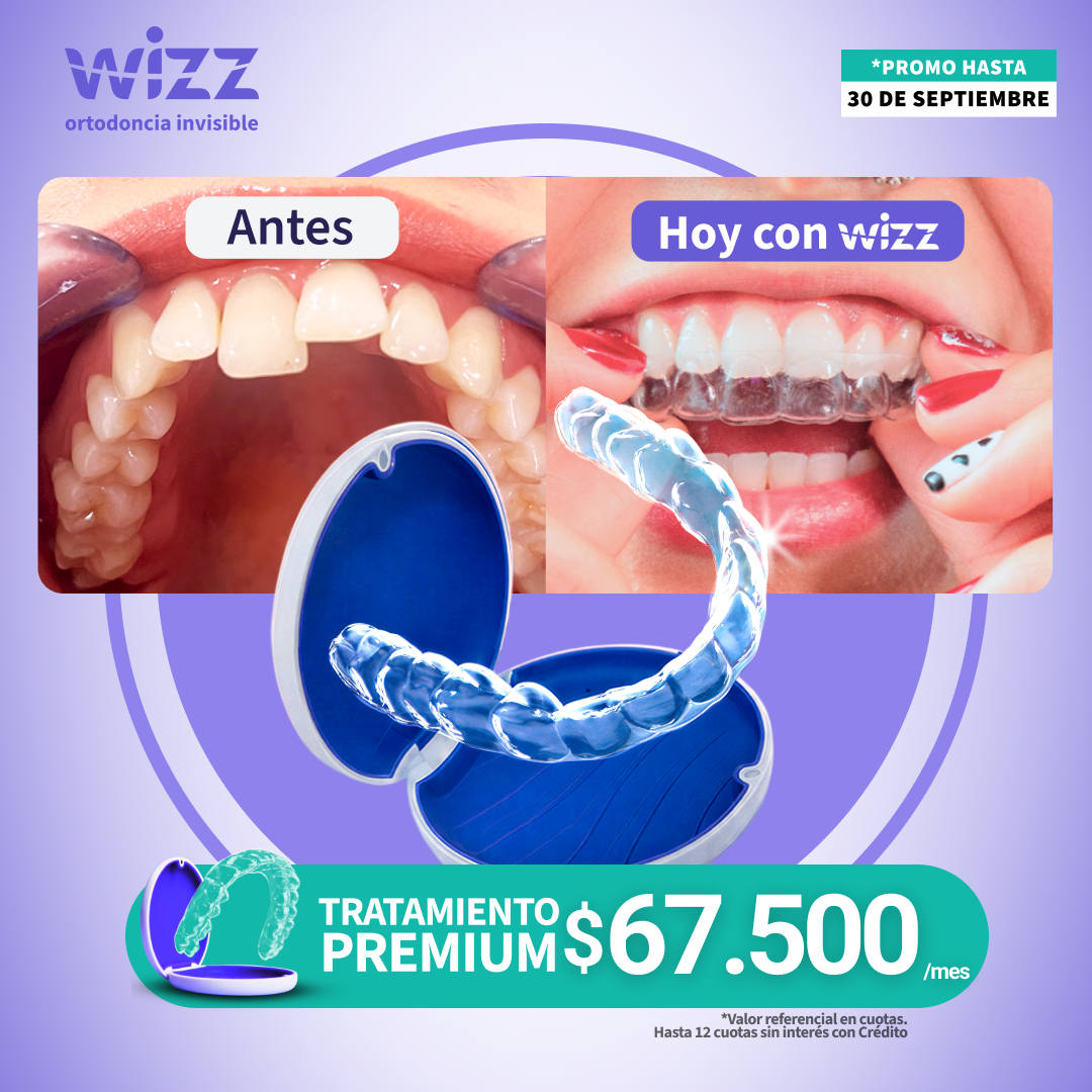 Wizz Chile Facebook ad: ¡Últimos días! Todos nuestros Tratamientos de Ortodoncia…