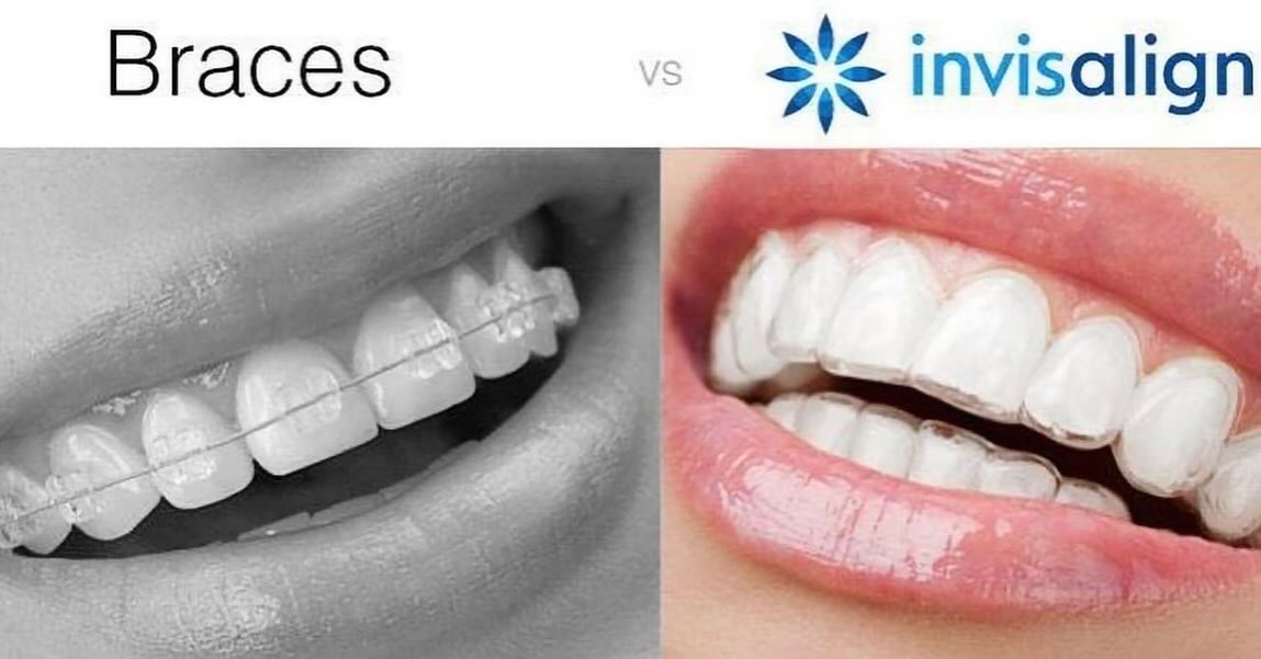 Upenn Barun Dental Clinic - English-speaking U.S. Orthodontist & Dentist Facebook ad: Located at Jamsilsaenae Station (Green Line) in Seoul…