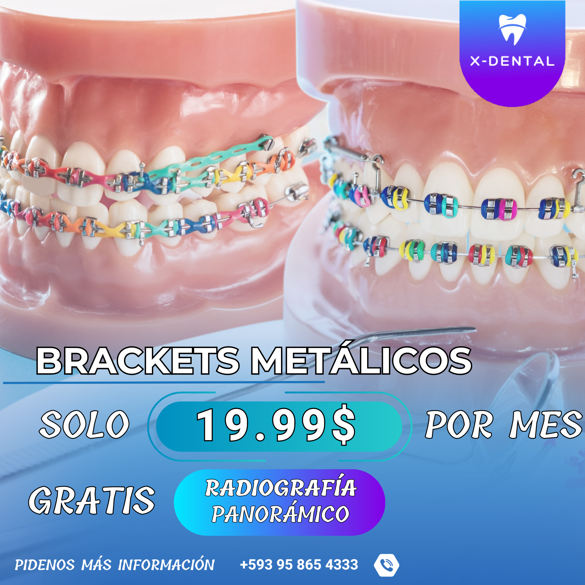 X-Dental G.S Facebook ad: POCAS CITAS DISPONIBLES