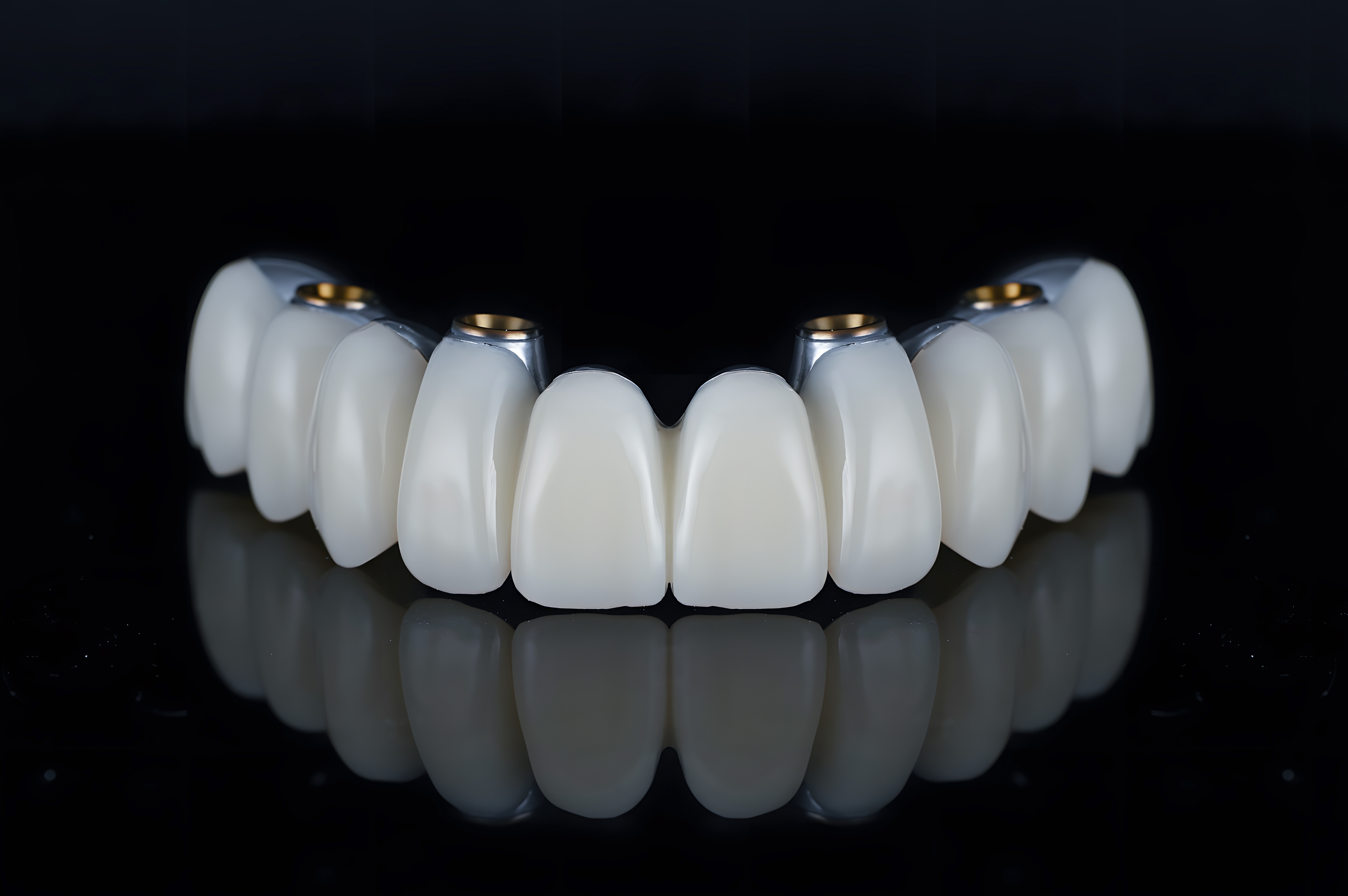 Olney Dental Wellness Facebook ad: Limited to 50 Patients: All-on-4s Discount Program!