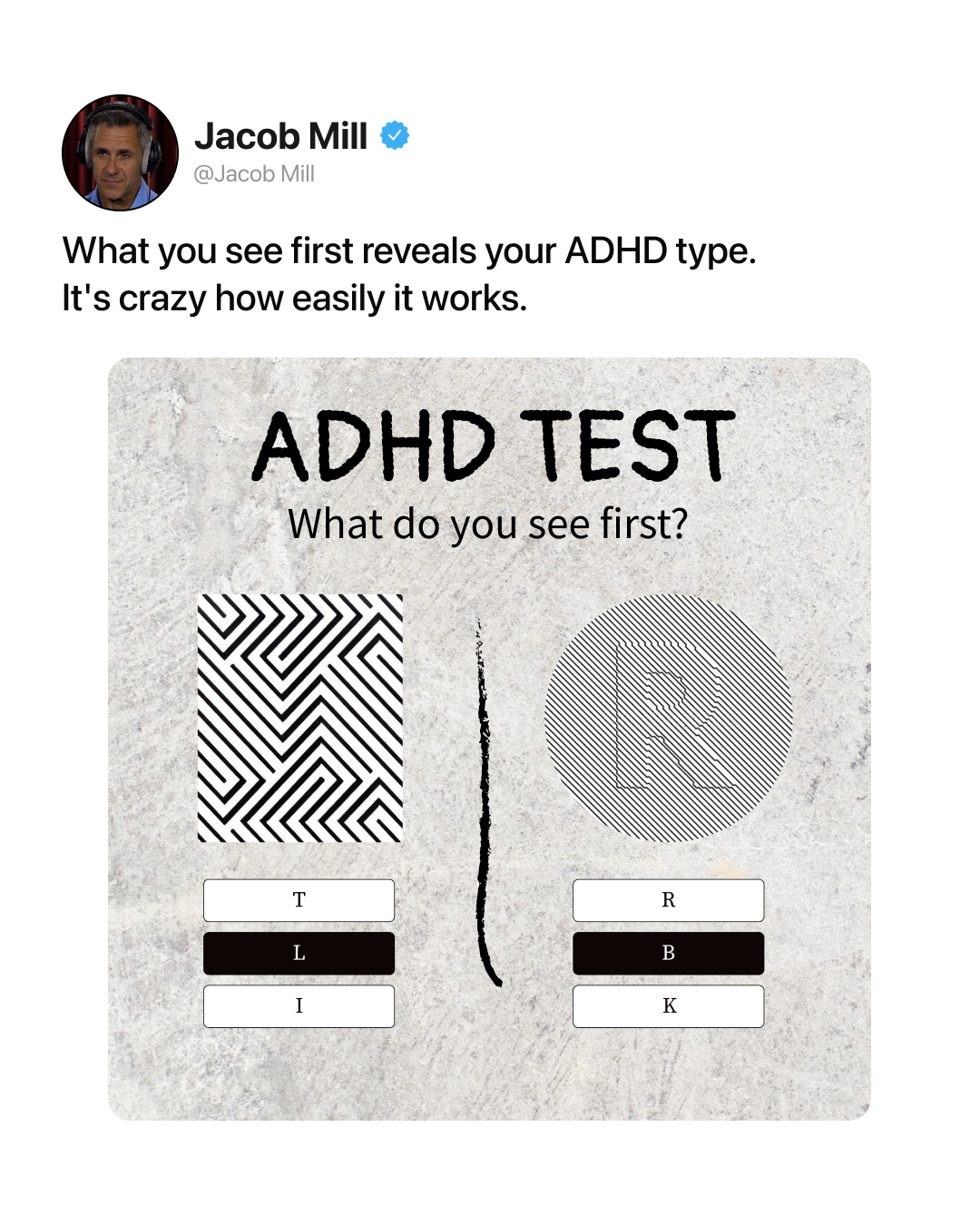 Rewire your ADHD brain Facebook ad