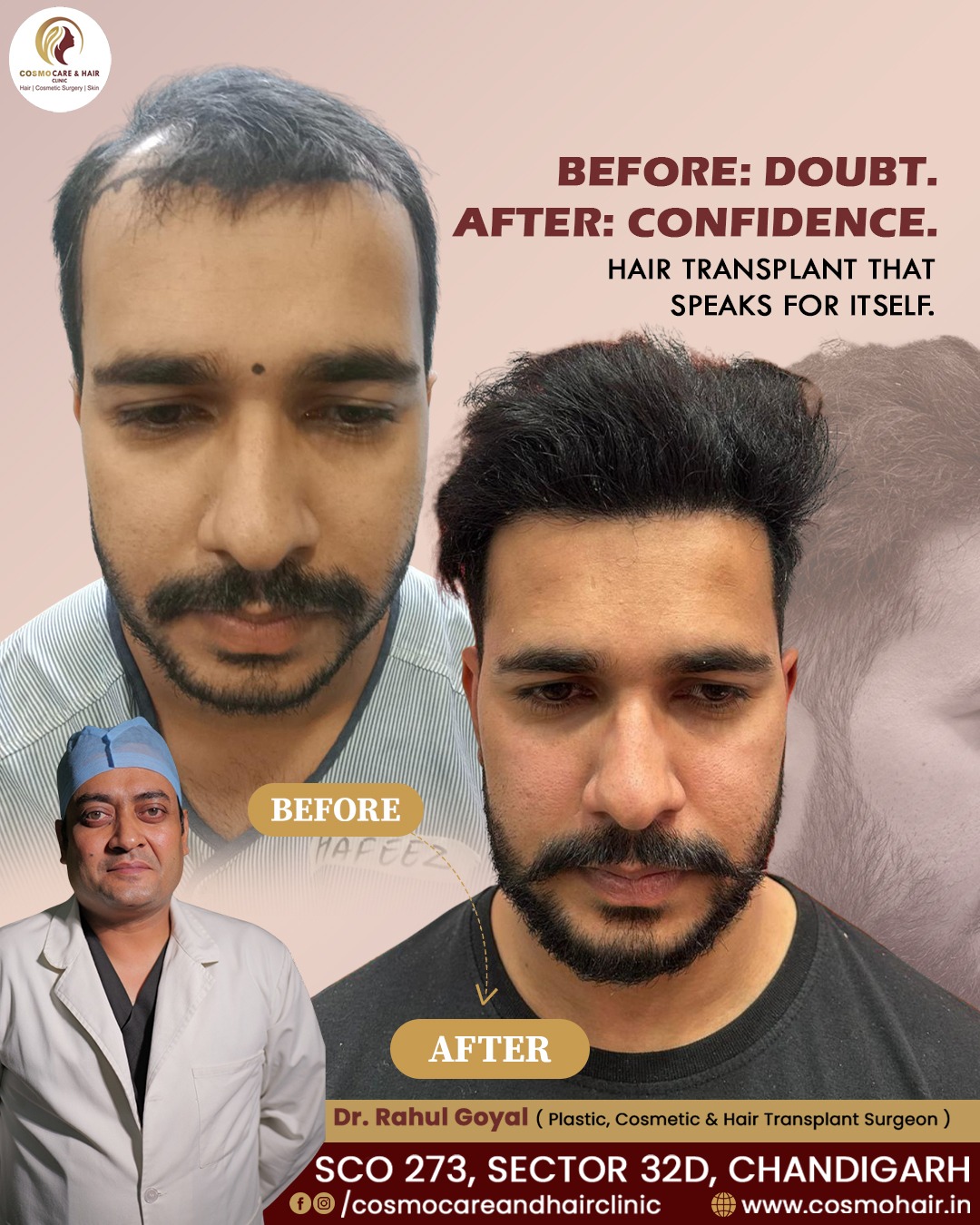 Cosmo Care & Hair Clinic - Chandigarh Facebook ad: Chat with us