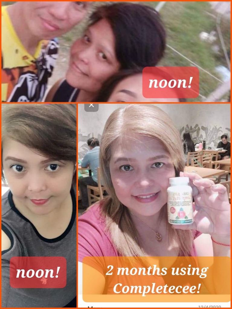 Collagen n Calcium Ascorbate Facebook ad: DALI MAY PROMO TAYO NGAYON!