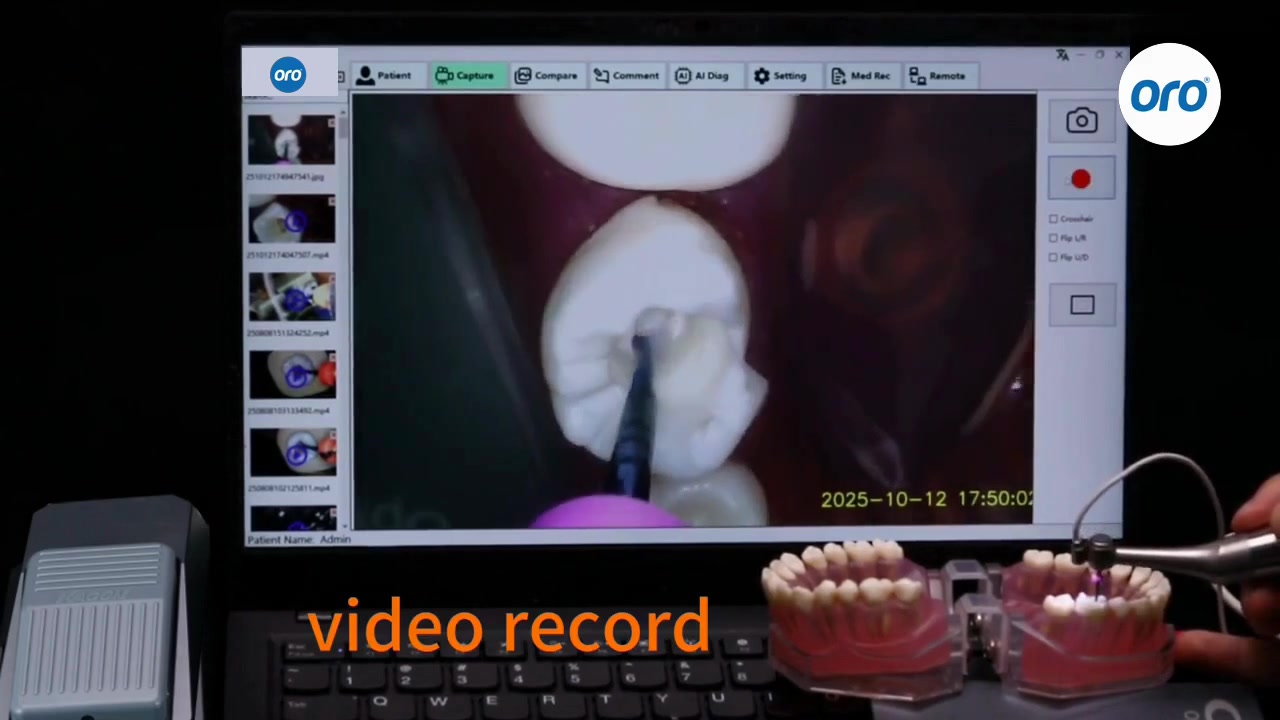ORO Facebook ad: Endo Micro Camera