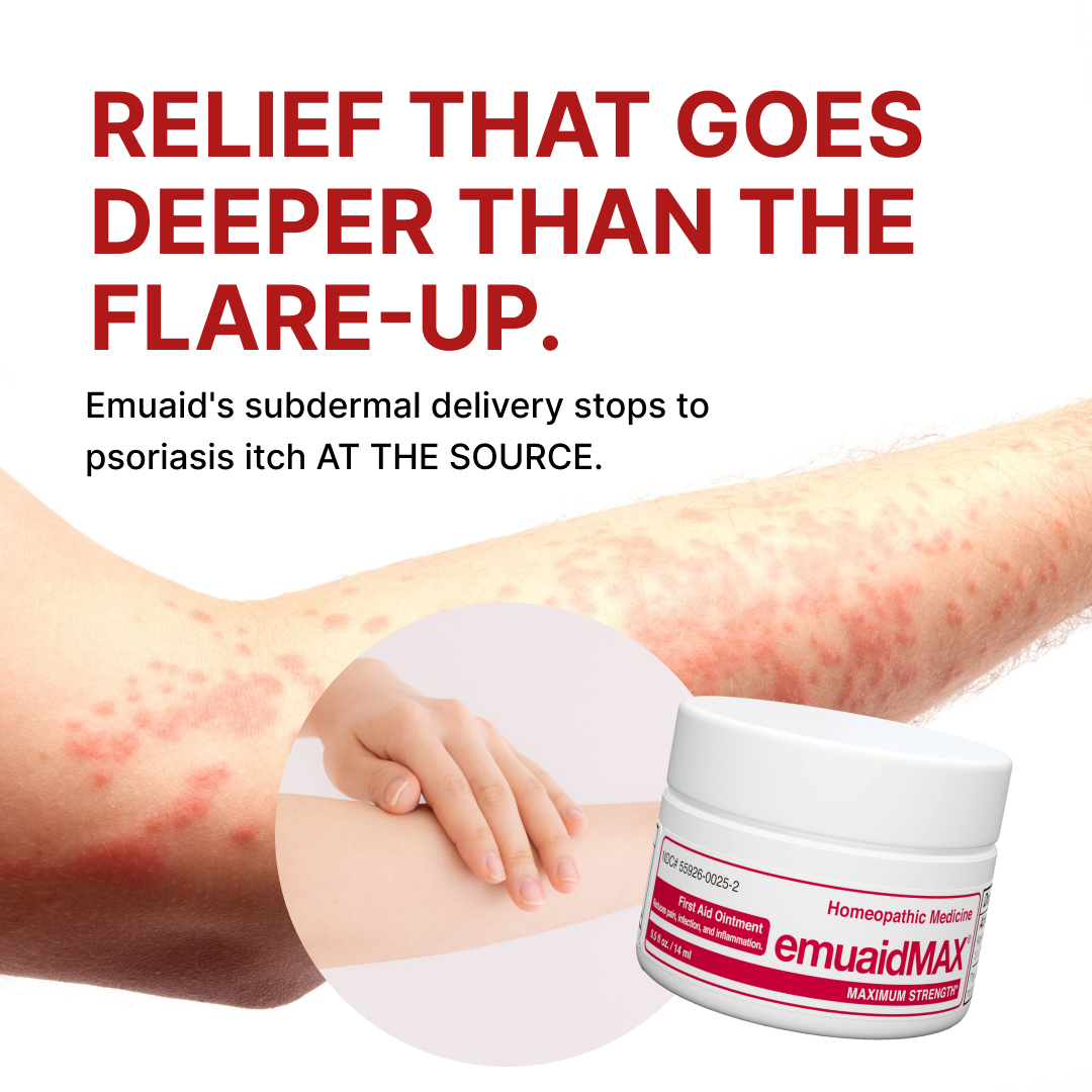 Emuaid Facebook ad