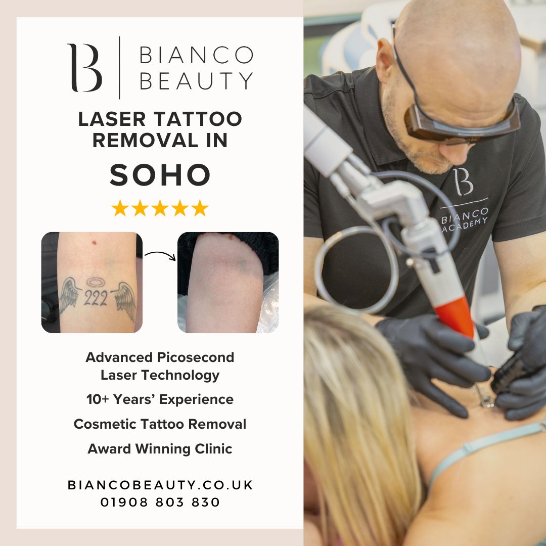 Bianco Beauty Facebook ad: Tattoo Regret? We’ll Make It Disappear Completely.