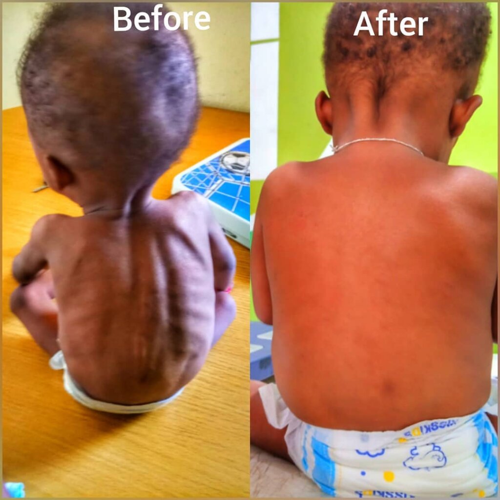 Chubby baby meal Facebook ad: Slim Child? Join This WhatsApp Class