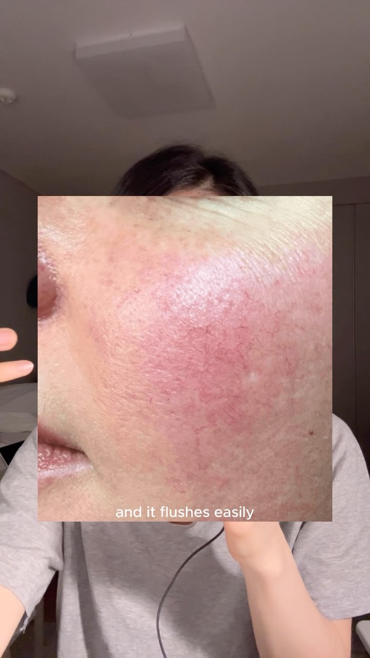 Dr.Reju-All Facebook ad: If your skin is thinning, more sensitive and…