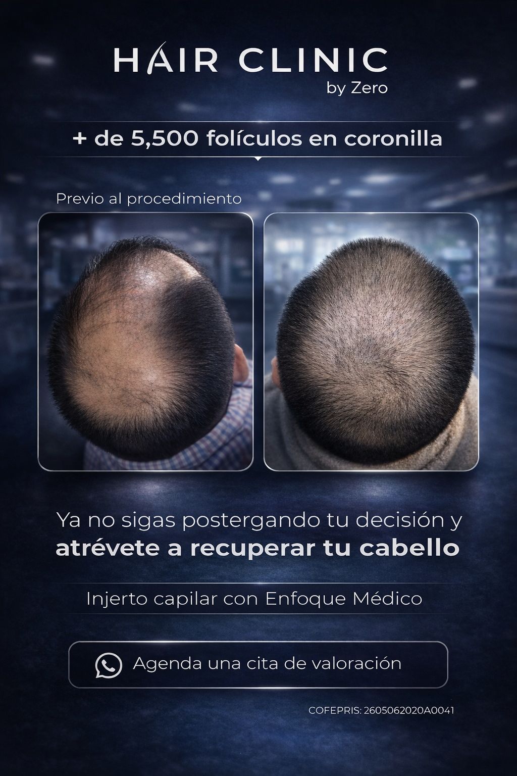Hair Clinic By Zero Facebook ad: ¡Agenda una cita de valoración!