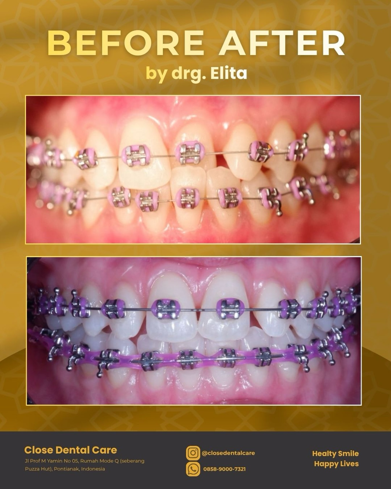 closedentalcare Facebook ad: Before & after Close Dental Care Karena senyum…