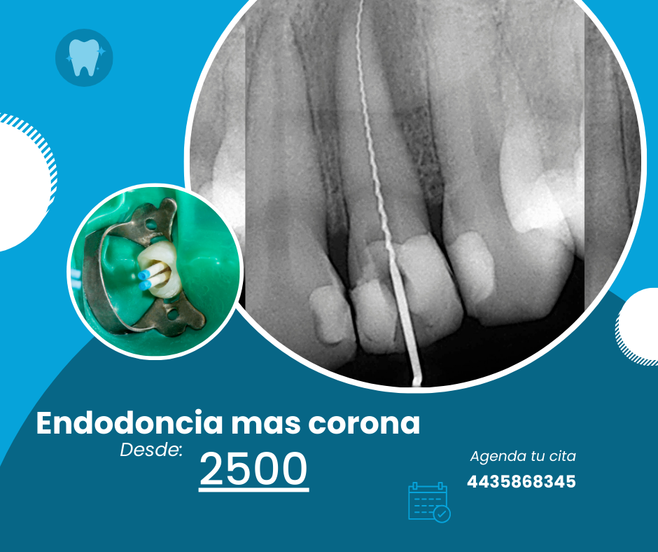 Odontuz Facebook ad: MORELIA CENTRO