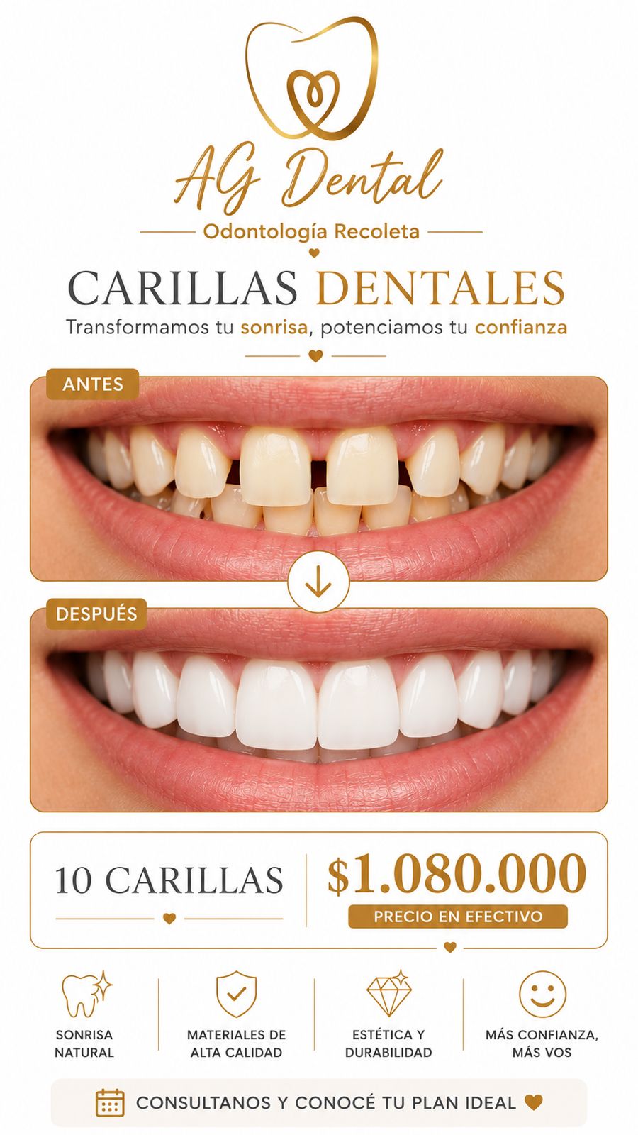 Odontologa Analia Gimenez Facebook ad: Carillas de Resina