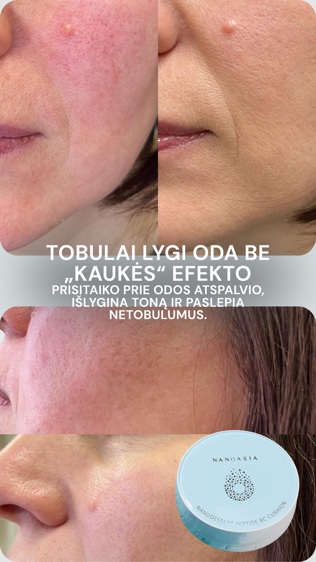 Esteskin by Laura Los Facebook ad