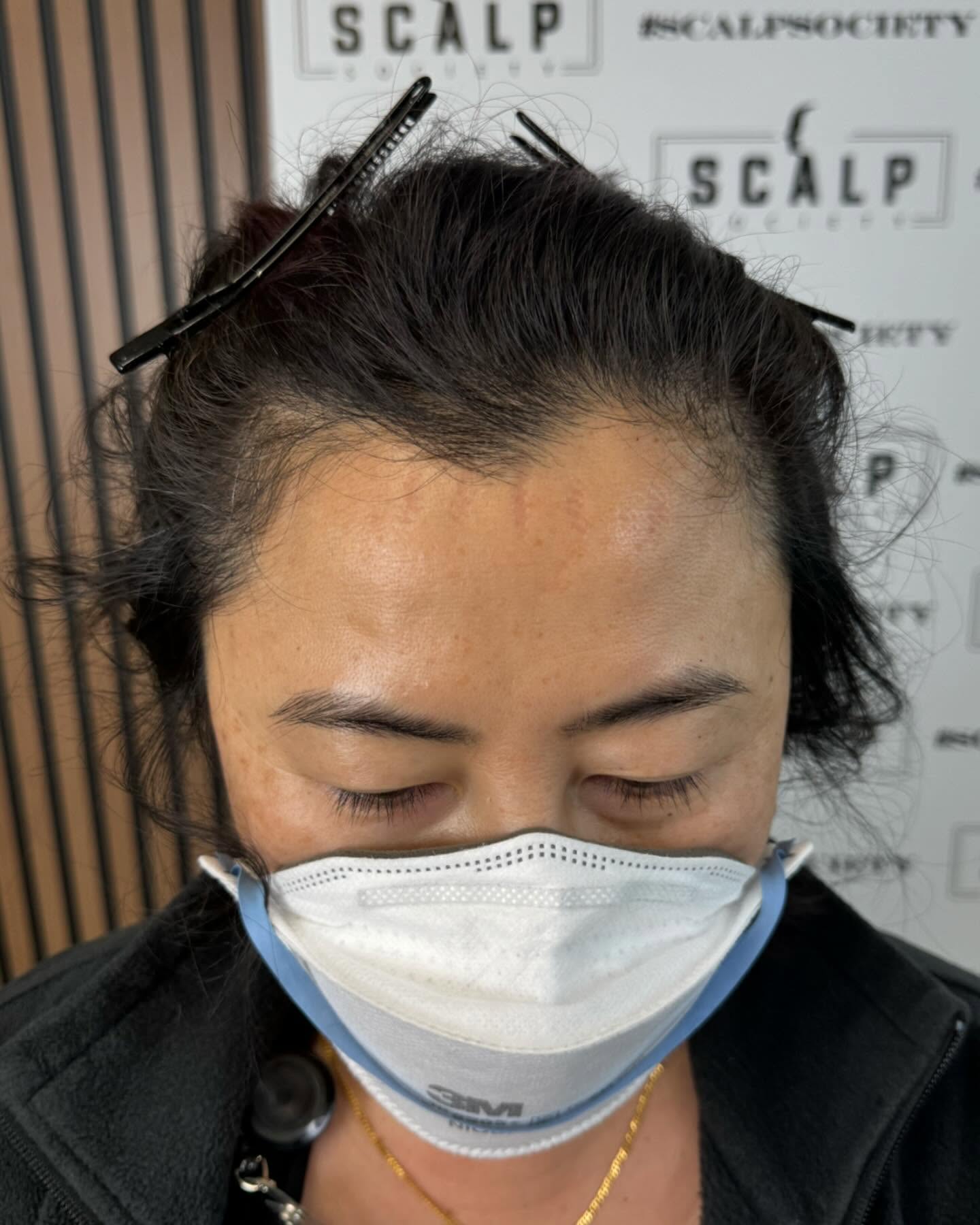 Scalp Society - Scalp Micropigmentation Clinic Facebook ad