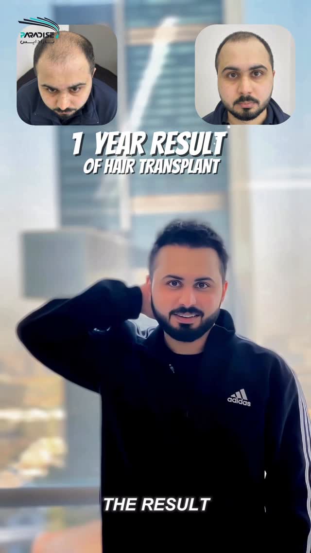Paradise Polyclinic Facebook ad: 1 year Stunning Transformation